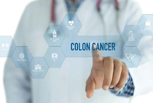 Colon Cancer Surgery