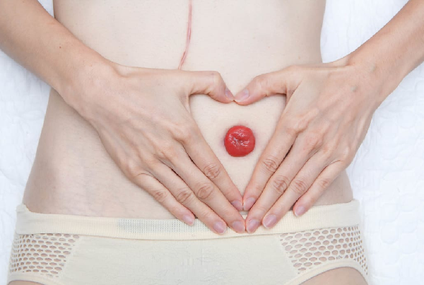 Colostomy